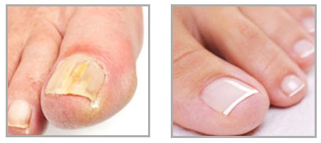 Clear Nail Plus Reviews