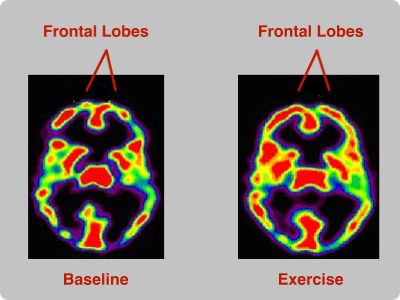 Blue Heron Health News The Brain Booster Before And After